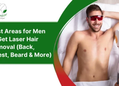 laser hair removal for men
